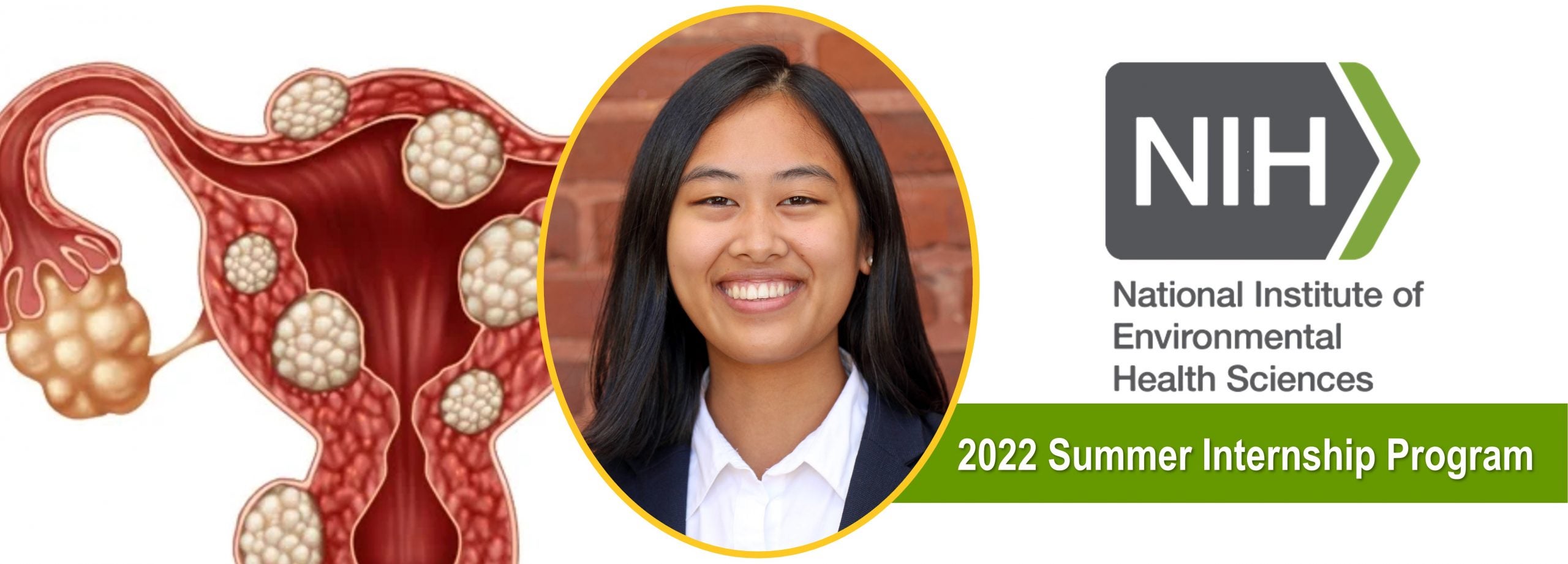 Read more about the article BS Environmental Health Student Accepts 2022 Summer NIEHS Internship